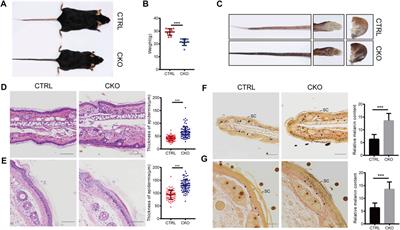 Ufl1 deficiency causes skin pigmentation by up-regulation of Endothelin-1